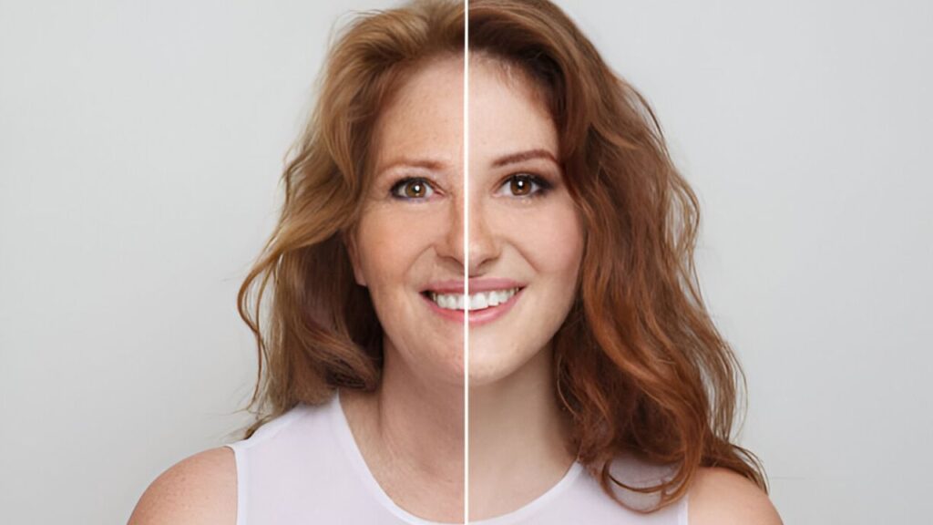 A picture of Fading Blemishes and Wrinkles before after